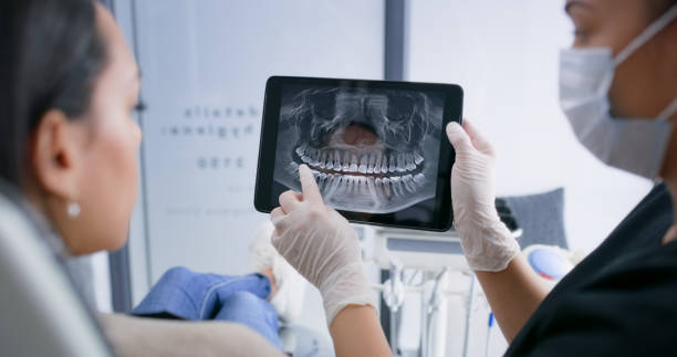 Licensed Dental Crowns And Bridges service in University of California-Santa Barbara, CA - Smile Center Dentistry